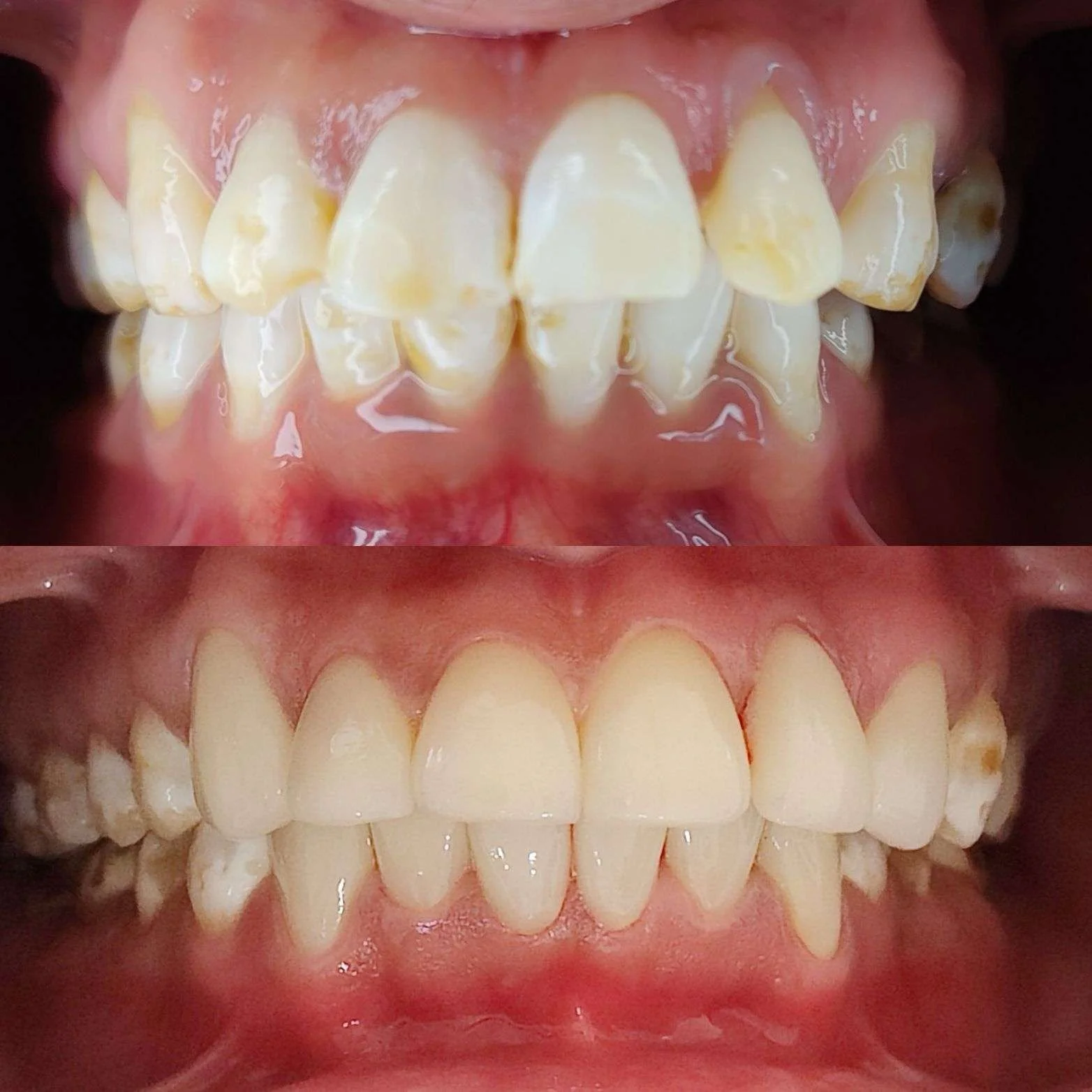 Before-After-1.webp