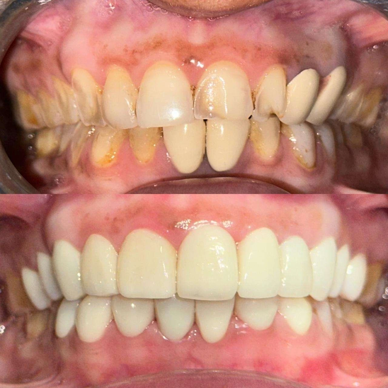 Before-After-10.webp