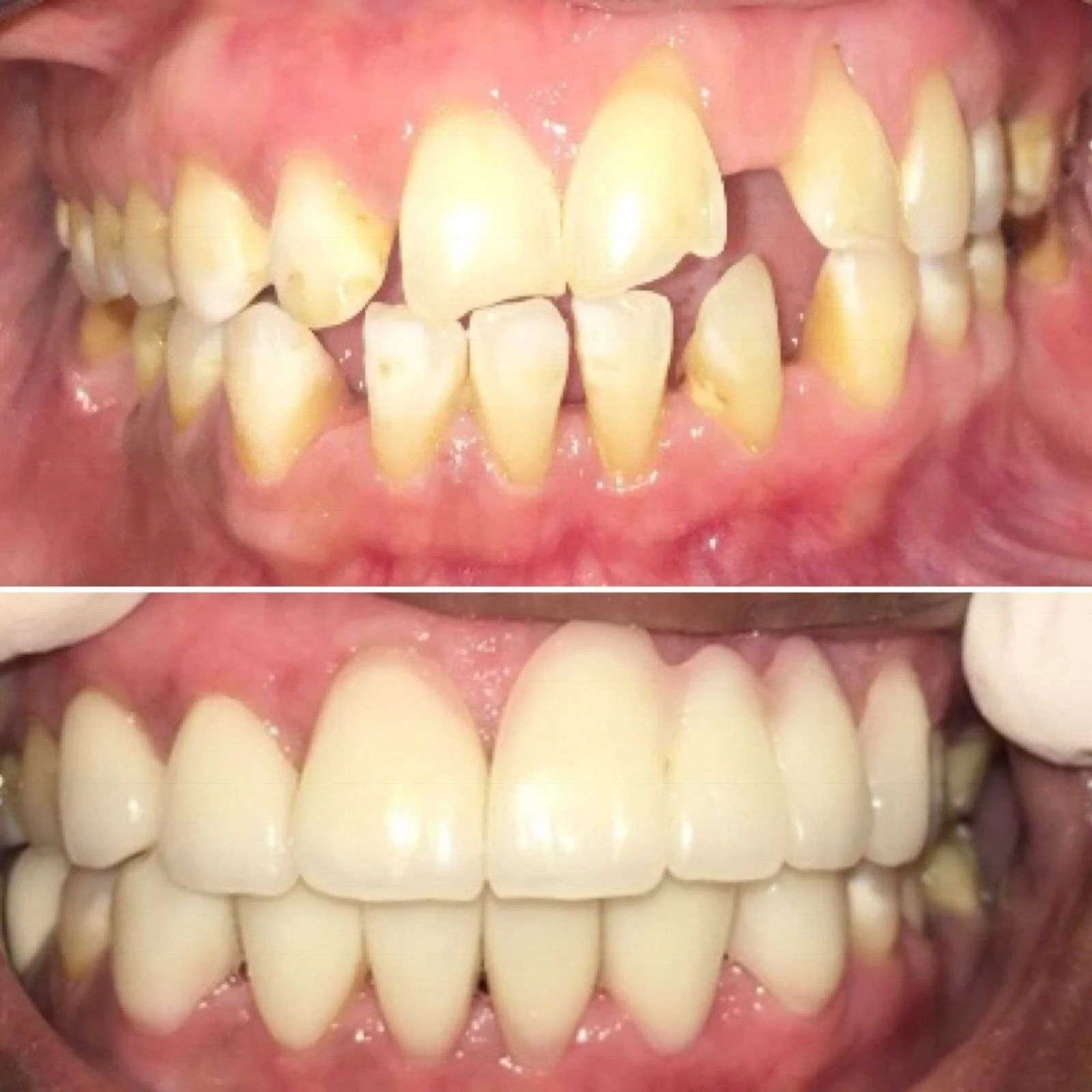 Before-After-2.webp