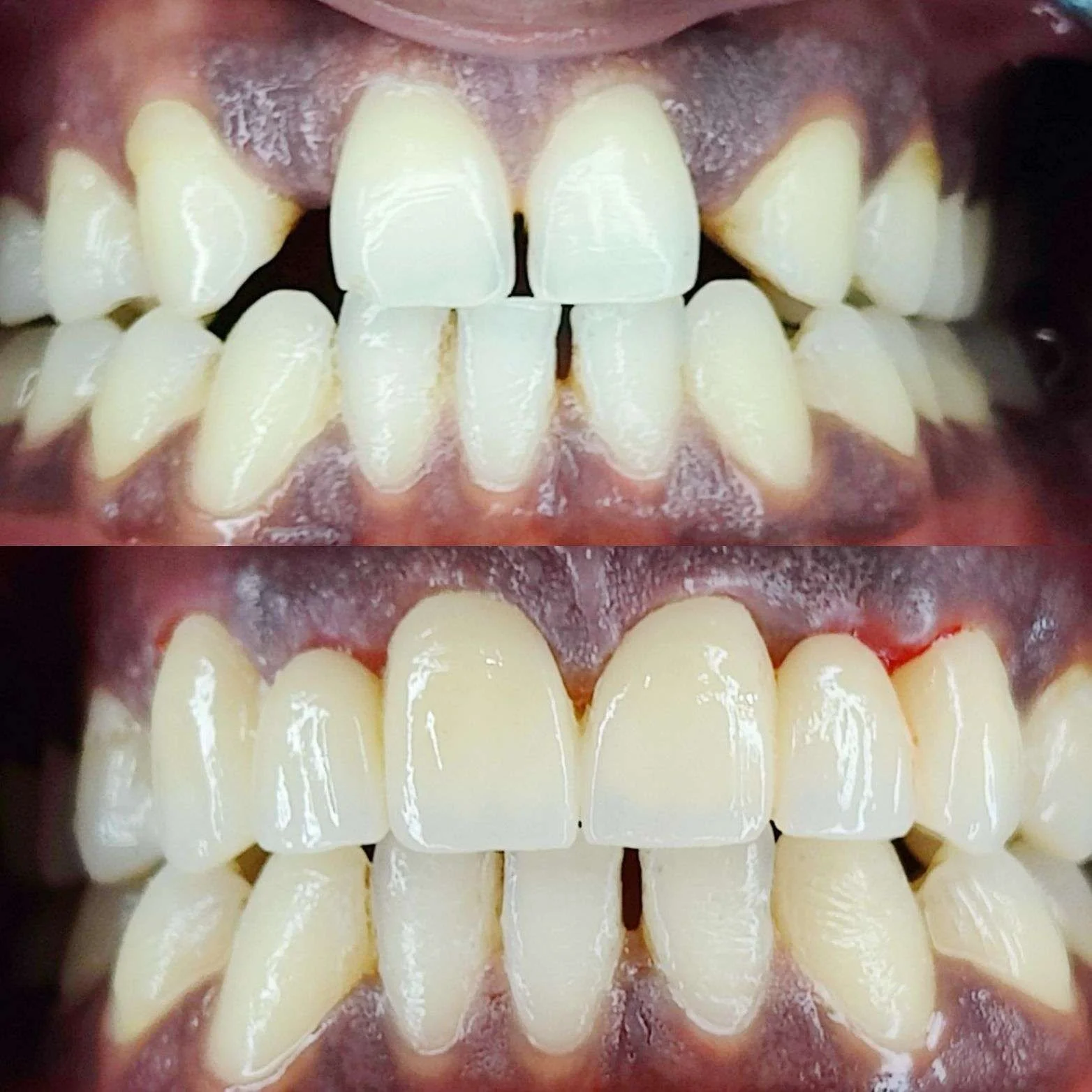 Before-After-3.webp