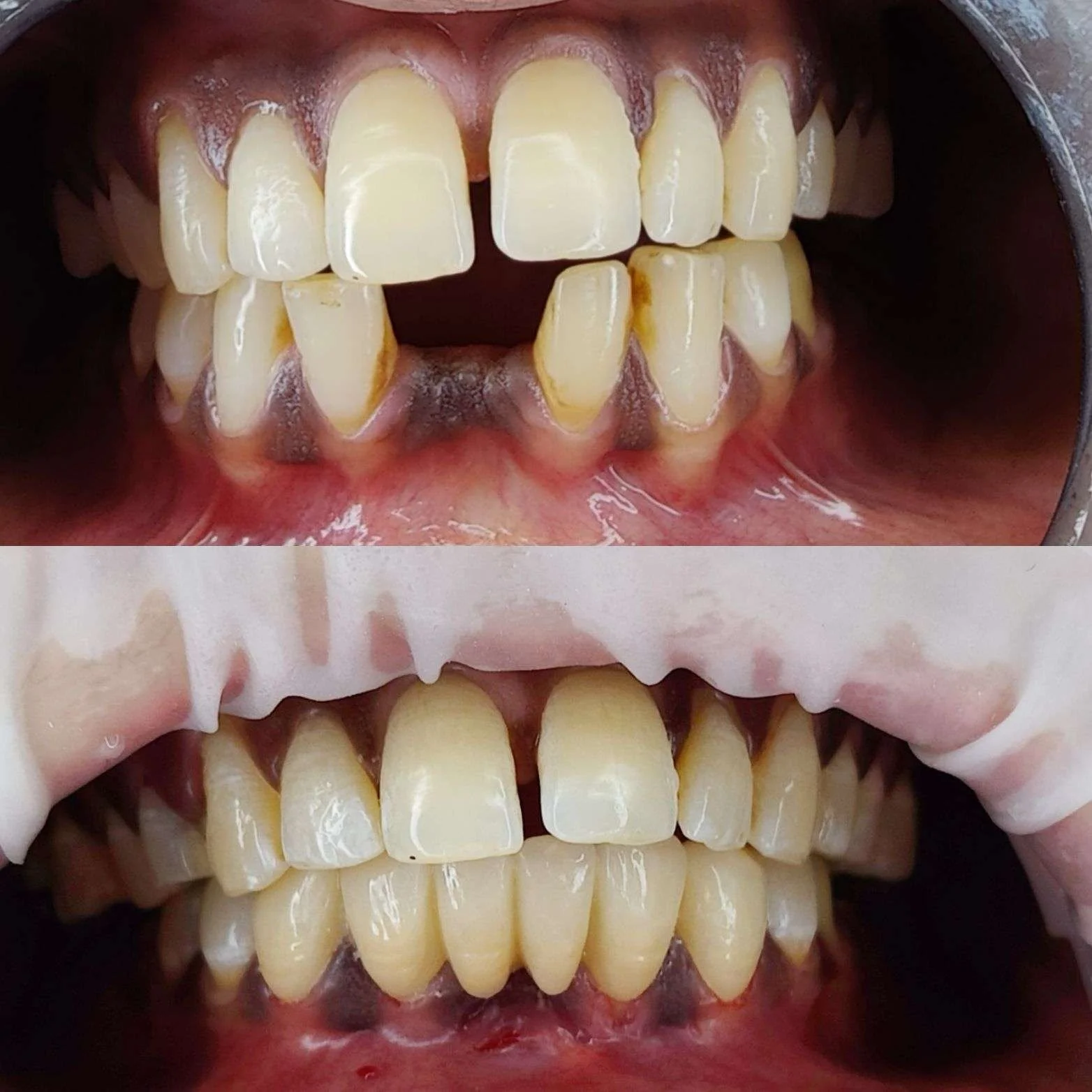 Before-After-4.webp