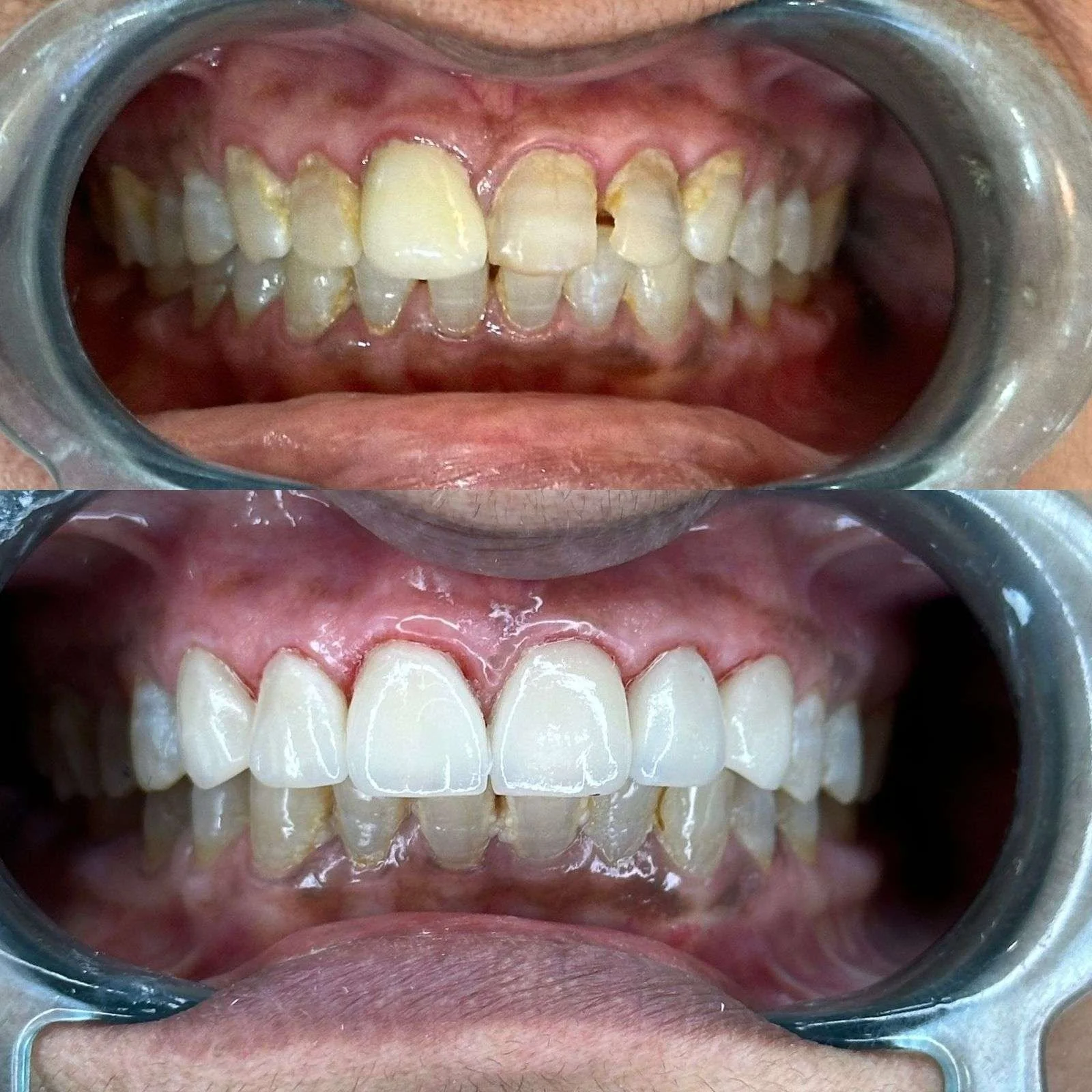 Before-After-5.webp