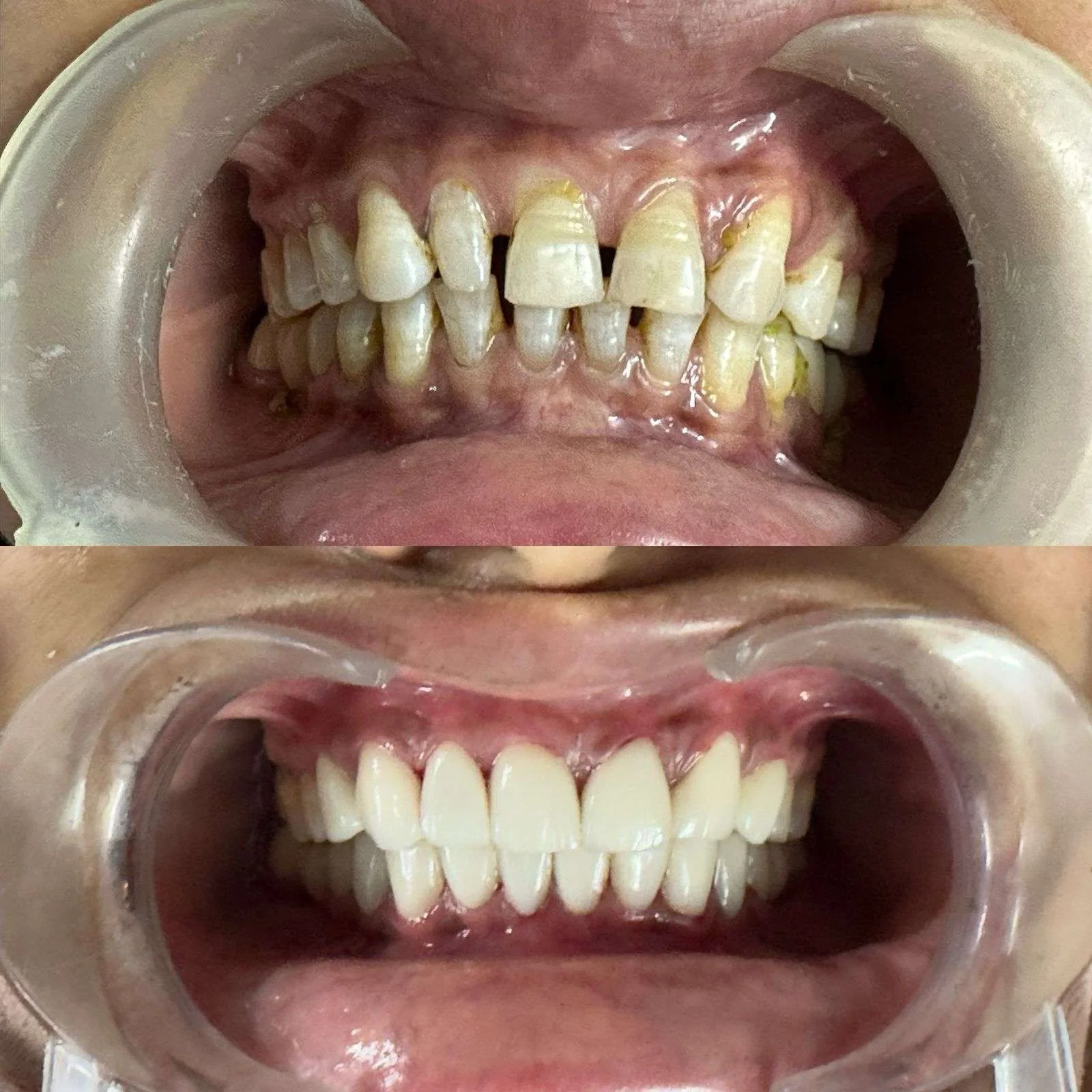 Before-After-6.webp