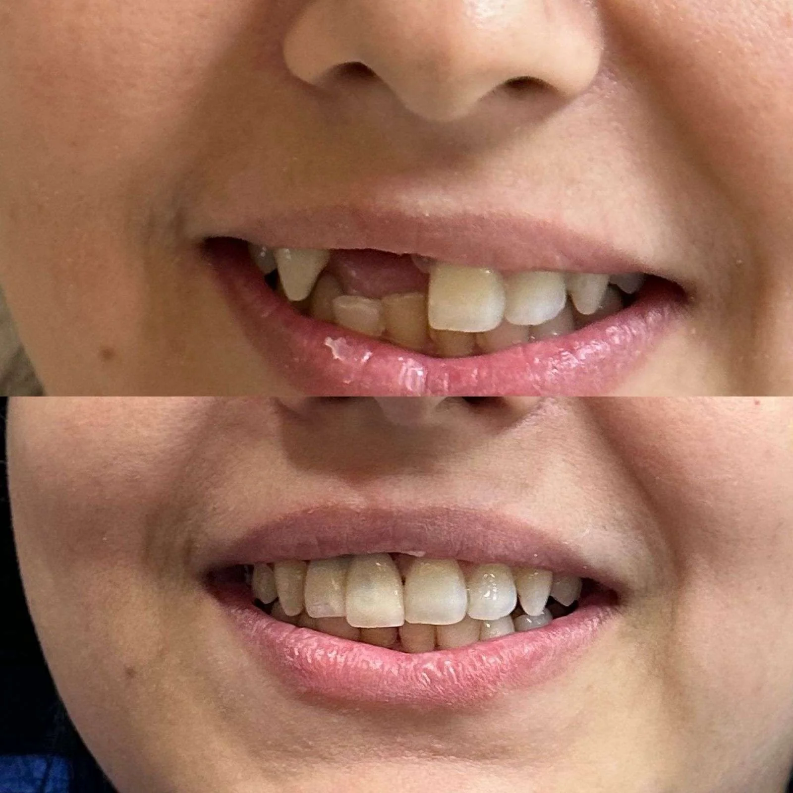 Before-After-7.webp