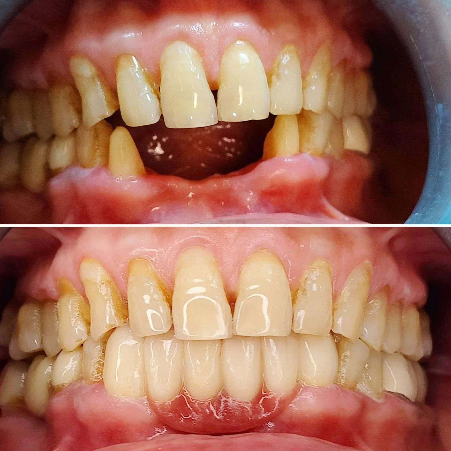 Before-After-8.webp