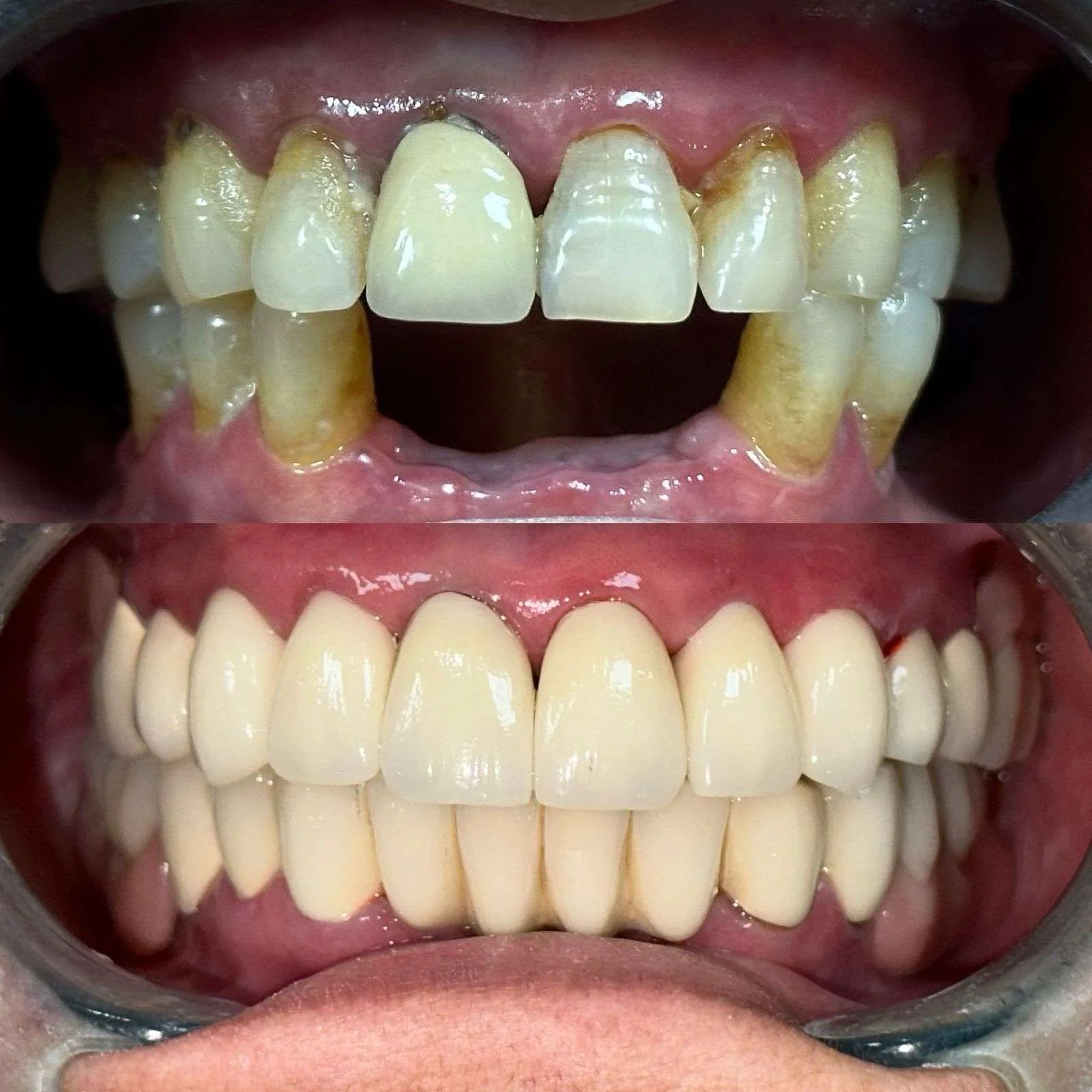 Before-After-9.webp