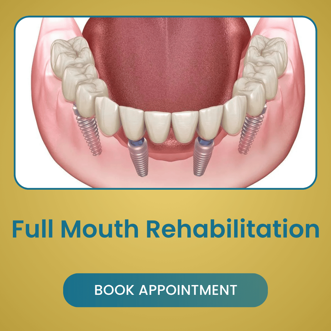 Full Mouth Rehabilitation