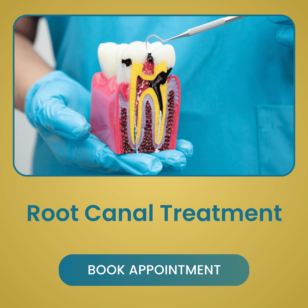 Root Canal Treatment