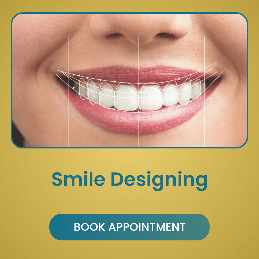 Smile Designing