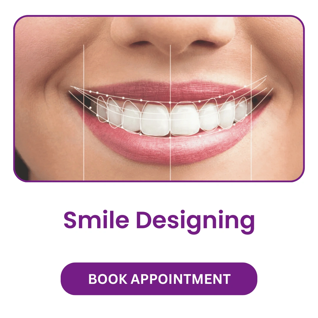 Smile-Designing.webp