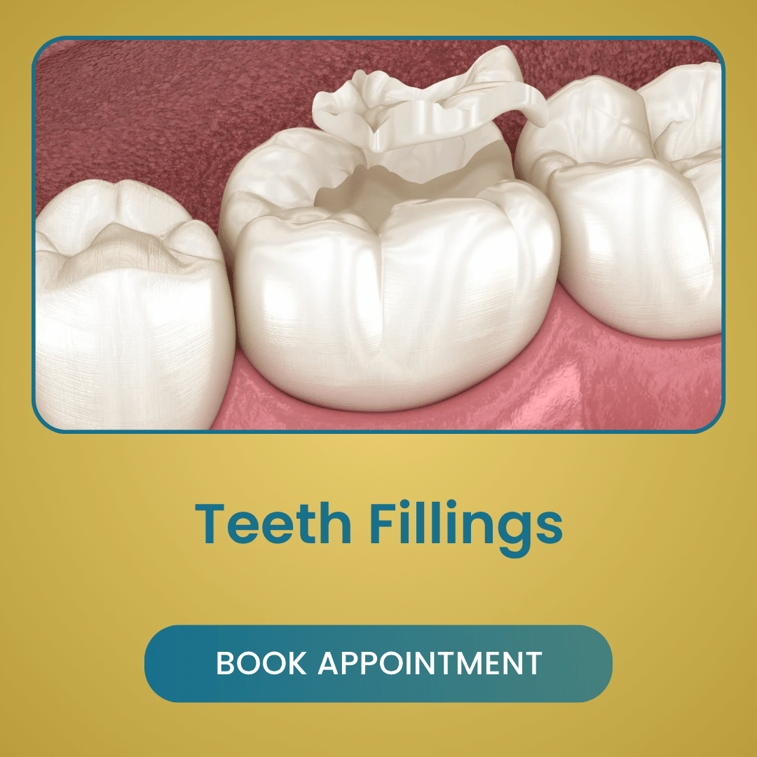 Teeth Fillings