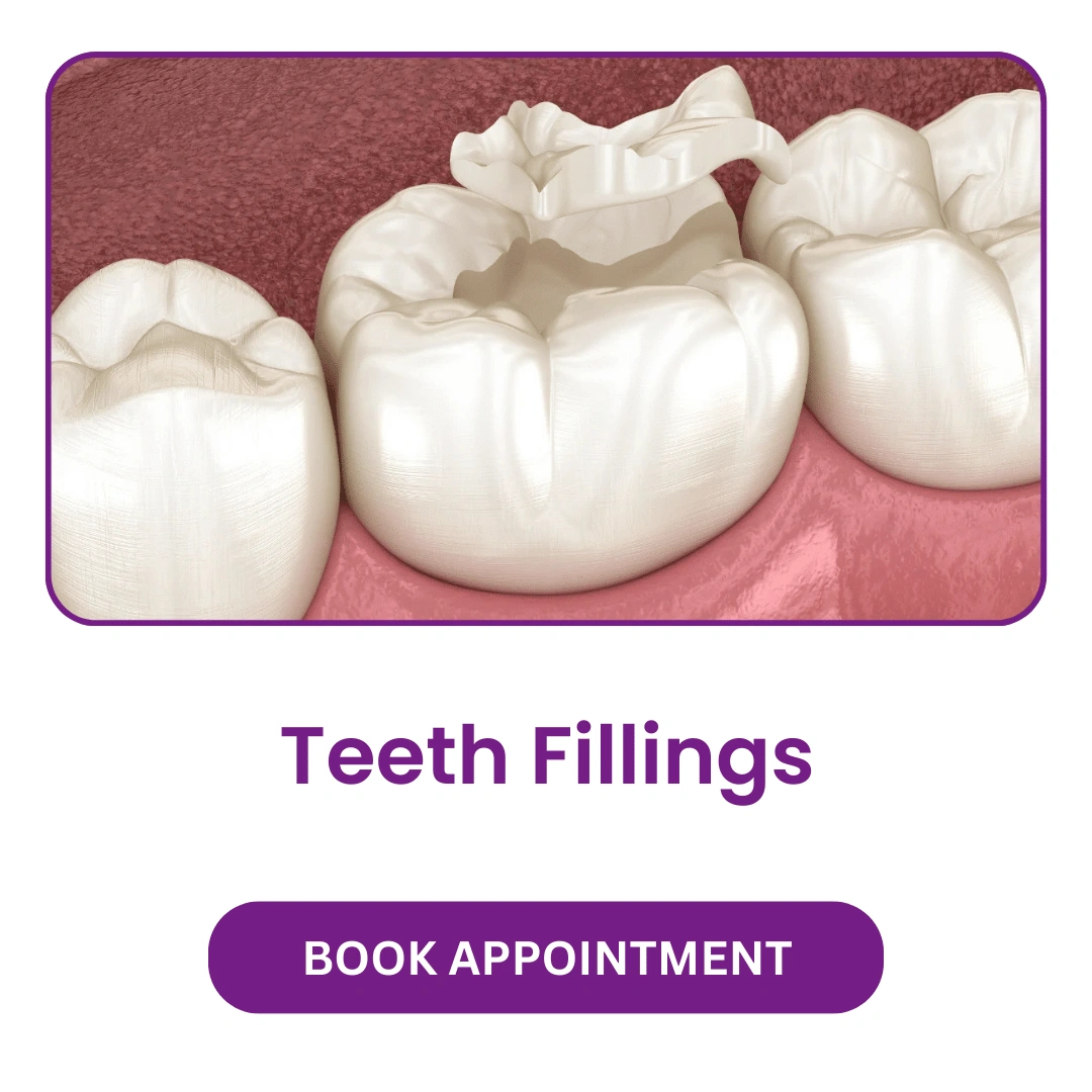 Teeth-Fillings.webp