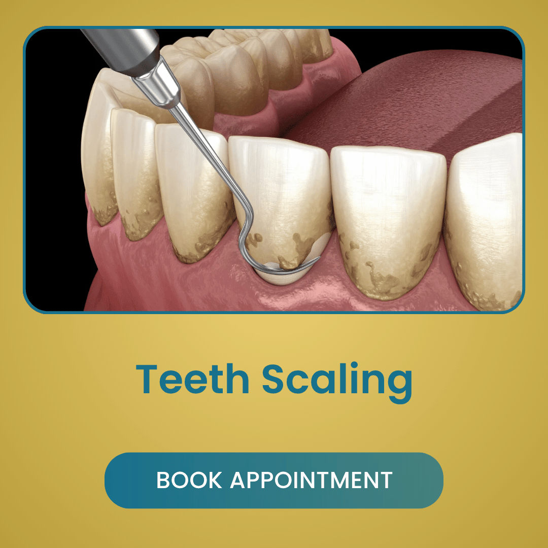 Teeth Scaling