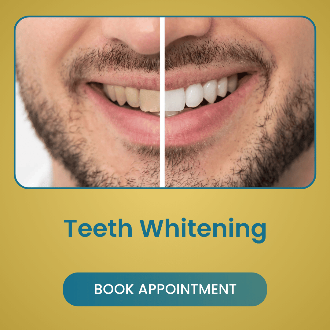 Teeth Whitening