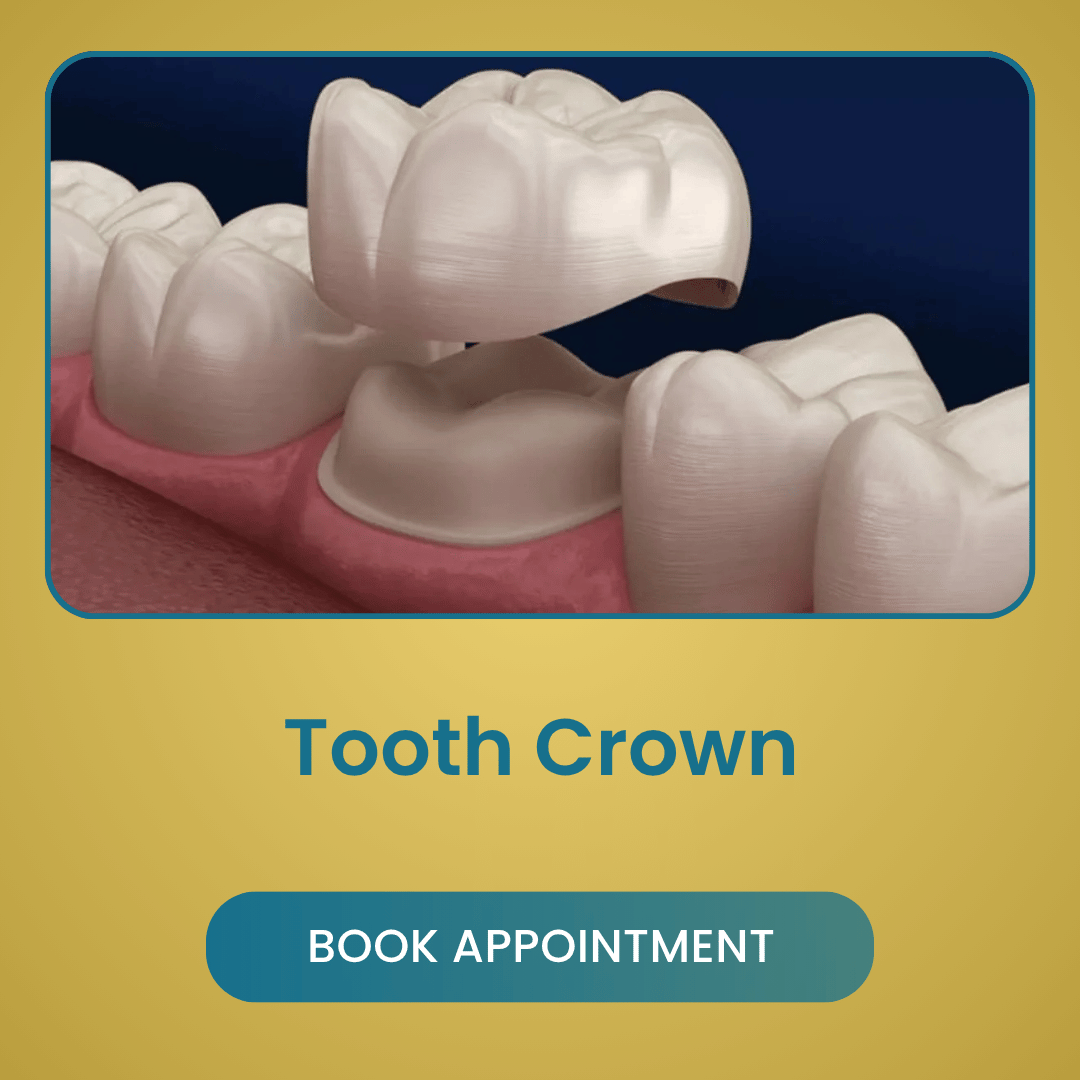 Tooth Crown