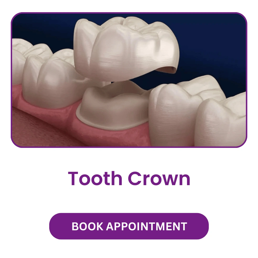 Tooth-Crown.webp